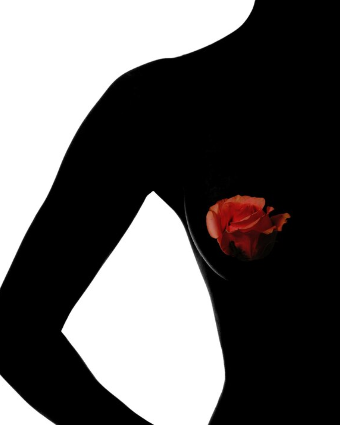 Nipple Areola correction